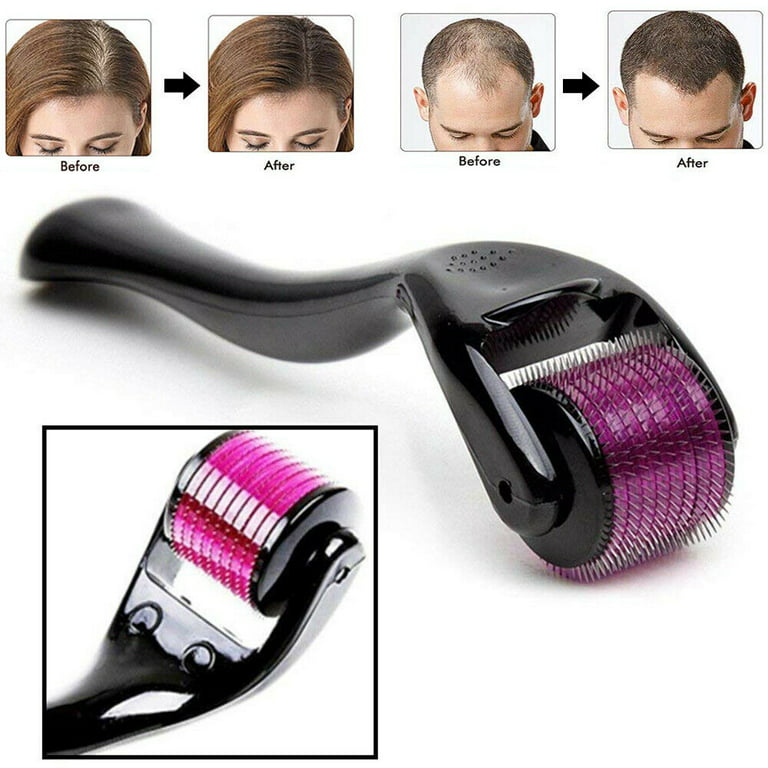 3-in-1 Facial Roller Set – Jade, Ice & Derma rollers